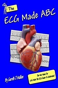 The ECG Made ABC (Paperback)
