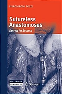 Sutureless Anastomoses: Secrets for Success (Paperback)