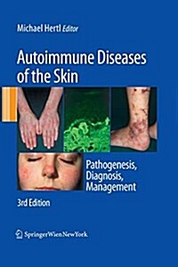 Autoimmune Diseases of the Skin: Pathogenesis, Diagnosis, Management (Paperback)
