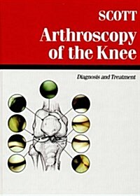 Arthroscopy of the Knee (Hardcover)