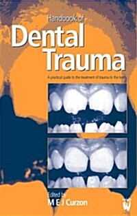 Handbook of Dental Trauma (Paperback)