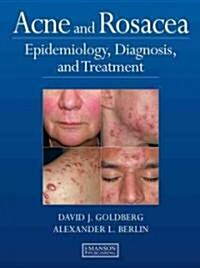 Acne and Rosacea : Epidemiology, Diagnosis and Treatment (Hardcover)
