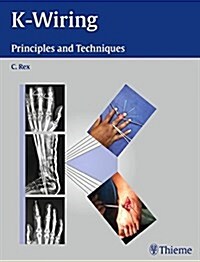 K-Wiring: Principles and Techniques (Hardcover)