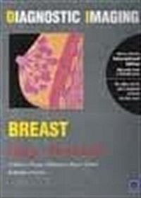 Diagnostic Imaging : Breast