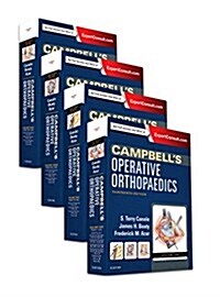 Campbells Operative Orthopaedics, 4-Volume Set (Hardcover, 13)