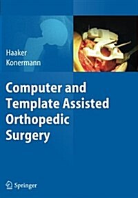 Computer and Template Assisted Orthopedic Surgery (Paperback, Softcover Repri)