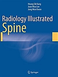 Radiology Illustrated: Spine (Paperback, Softcover Repri)