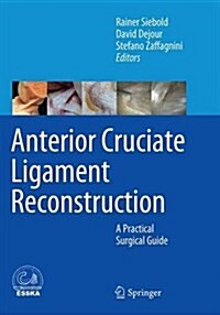 Anterior Cruciate Ligament Reconstruction: A Practical Surgical Guide (Paperback, Softcover Repri)