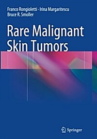 Rare Malignant Skin Tumors (Paperback, Softcover Repri)