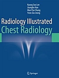 Radiology Illustrated: Chest Radiology (Paperback, Softcover Repri)
