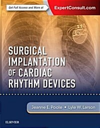 Surgical Implantation of Cardiac Rhythm Devices (Hardcover)