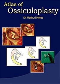 Atlas of Ossiculoplasty (Hardcover, DVD 미포함)