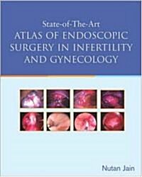 State of the Art Atlas of Endoscopic Surgery in Infertility and Gynecology (Paperback)