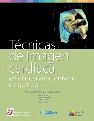 Tecnicas de Imagen Cardiaca (Paperback)