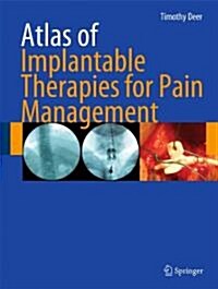 Atlas of Implantable Therapies for Pain Management (Hardcover, 1st)