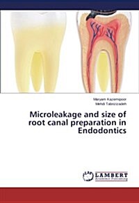 Microleakage and Size of Root Canal Preparation in Endodontics (Paperback)