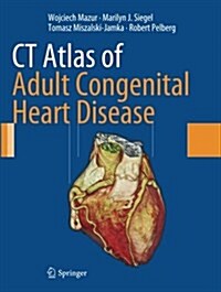 Ct Atlas of Adult Congenital Heart Disease (Paperback, Softcover reprint of the original 1st ed. 2013)
