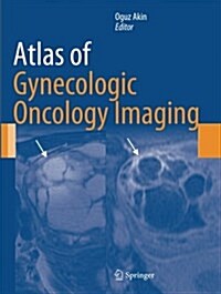 Atlas of Gynecologic Oncology Imaging (Paperback, Softcover Repri)