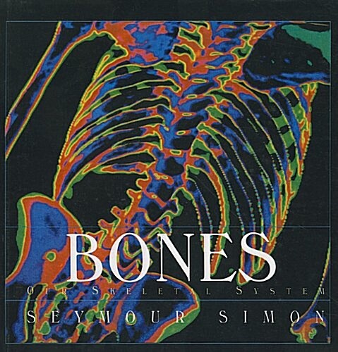 Bones: Our Skeletal System (Prebound)