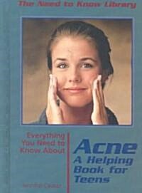 Everything You Need to Know about Acne (Library Binding)