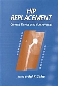 Hip Replacement: Current Trends and Controversies (Hardcover)