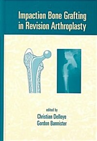 Impaction Bone Grafting in Revision Arthroplasty (Hardcover)