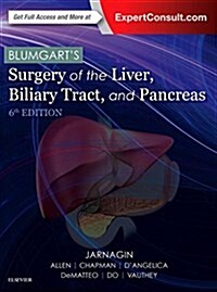 Blumgarts Surgery of the Liver, Biliary Tract, and Pancreas [With Free Web Access] (Hardcover, 6)