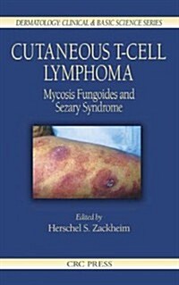 Cutaneous T-Cell Lymphoma: Mycosis Fungoides and Sezary Syndrome (Hardcover)