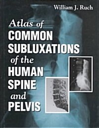 Atlas of Common Subluxations of the Human Spine and Pelvis (Hardcover)