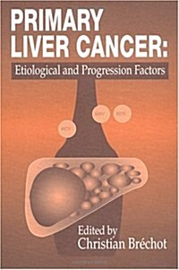Primary Liver Cancer: Etiological and Progression Factors (Hardcover)