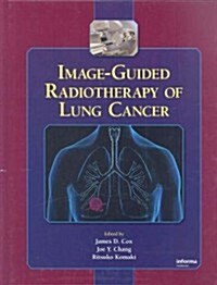 Image-Guided Radiotherapy of Lung Cancer (Hardcover)