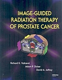 Image-Guided Radiation Therapy of Prostate Cancer (Hardcover)