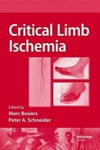 Critical Limb Ischemia (Hardcover)