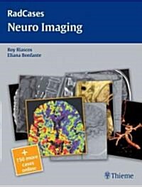 Radcases Neuro Imaging (Paperback)