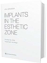 Implants in the Esthetic Zone (Hardcover)
