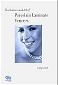 Science and Art of Porcelain Laminate Veneers (Hardcover)