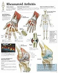 Rheumatoid Arthritis: Laminated Wall Chart (Other)