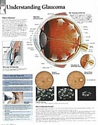 Understanding Glaucoma Chart: Wall Chart (Other)