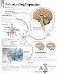 Understanding Depression Chart: Wall Chart (Other)