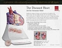 Life Size Diseased Heart Model (Hardcover)