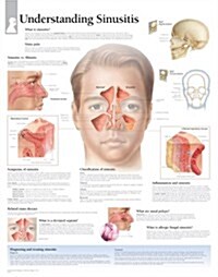 Understanding Sinusitis Chart: Laminated Wall Chart (Other)