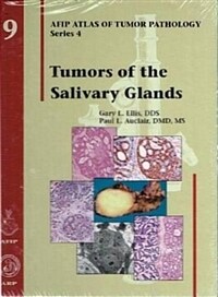 Tumors of the cervix, vagina, and vulva