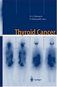 Thyroid Cancer (Hardcover, 2nd)