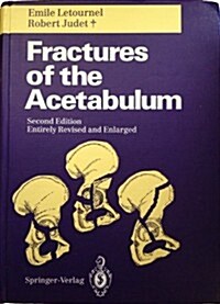Fractures of the Acetabulum (Hardcover)