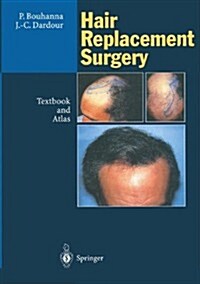 Hair Replacement Surgery: Textbook and Atlas (Hardcover)