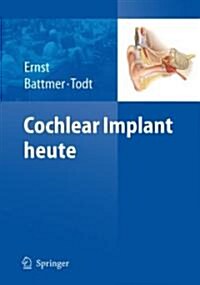 Cochlear Implant Heute (Paperback, 2009)