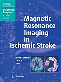 Magnetic Resonance Imaging in Ischemic Stroke (Paperback)