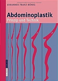 Abdominoplastik: Prinzip Und Technik (Hardcover)