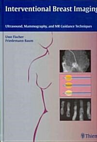 Interventional Breast Imaging: Ultrasound, Mammography, and MR Guidance Techniques (Hardcover)