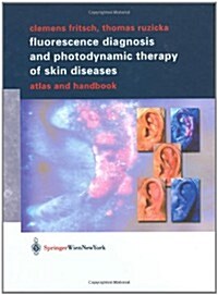 Fluorescence Diagnosis and Photodynamic Therapy of Skin Diseases: Atlas and Handbook (Hardcover, 2003)